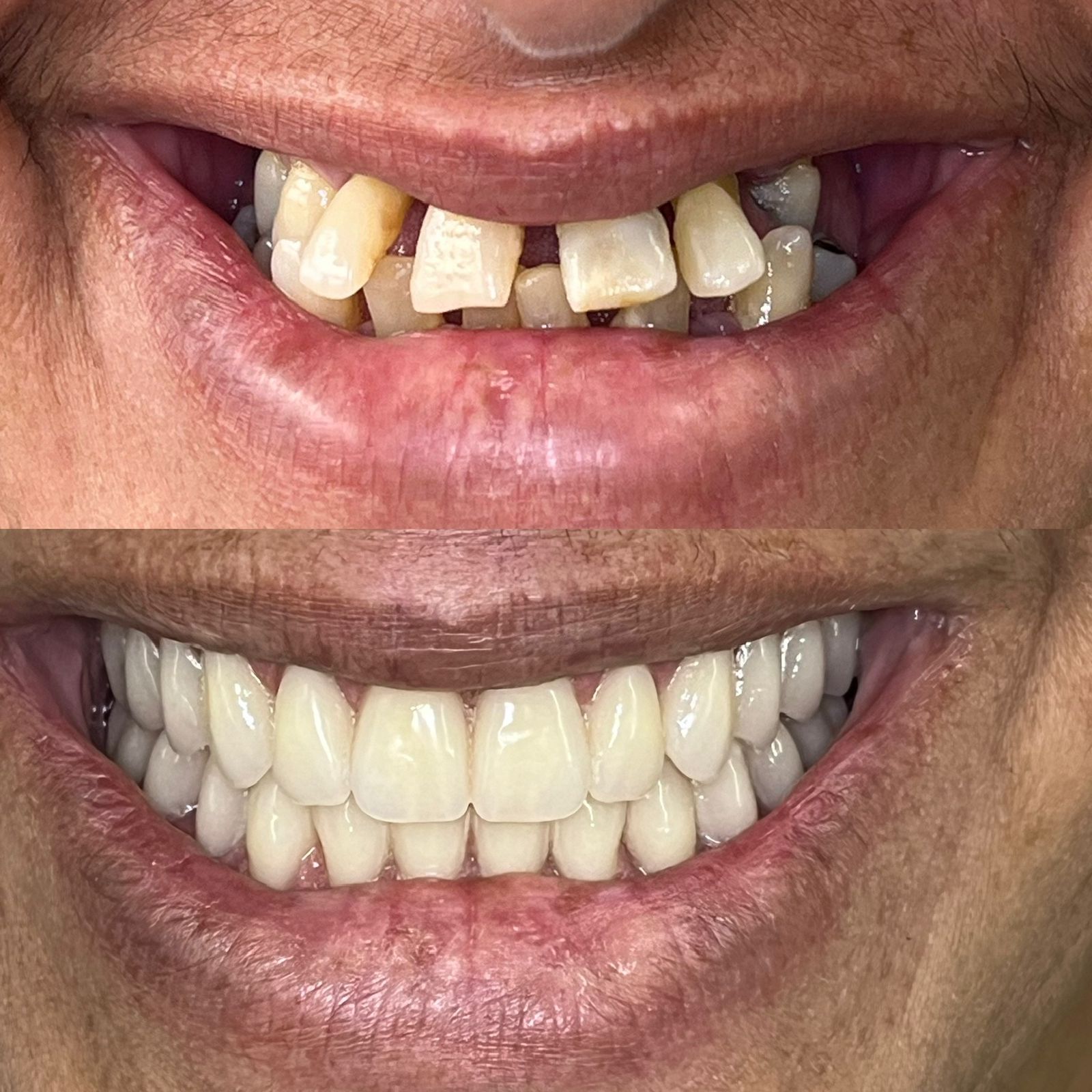 antes-depois-dr-fabio-moura-12