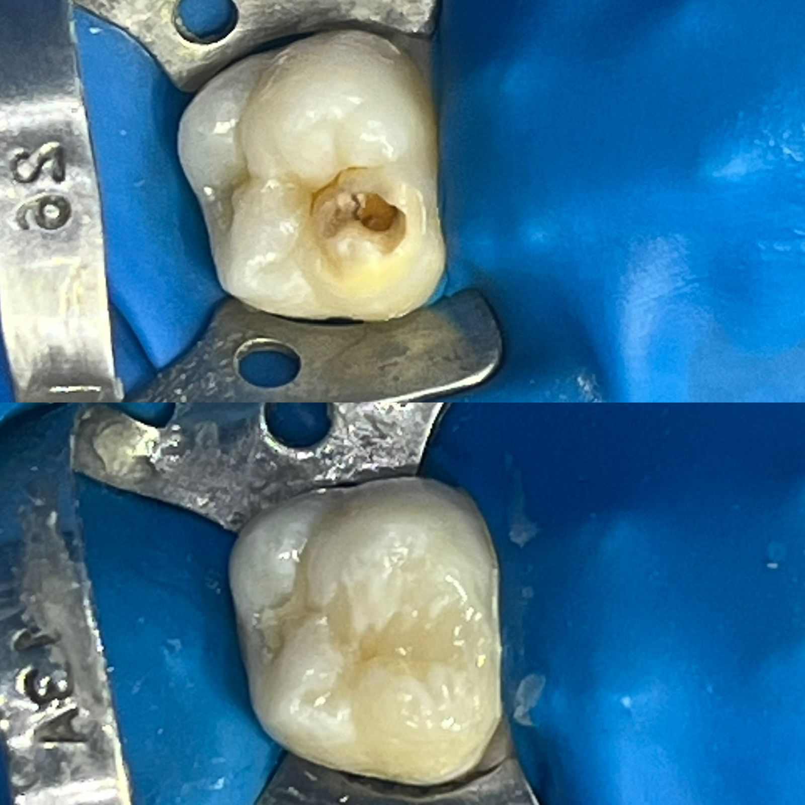 antes-depois-dr-fabio-moura-16