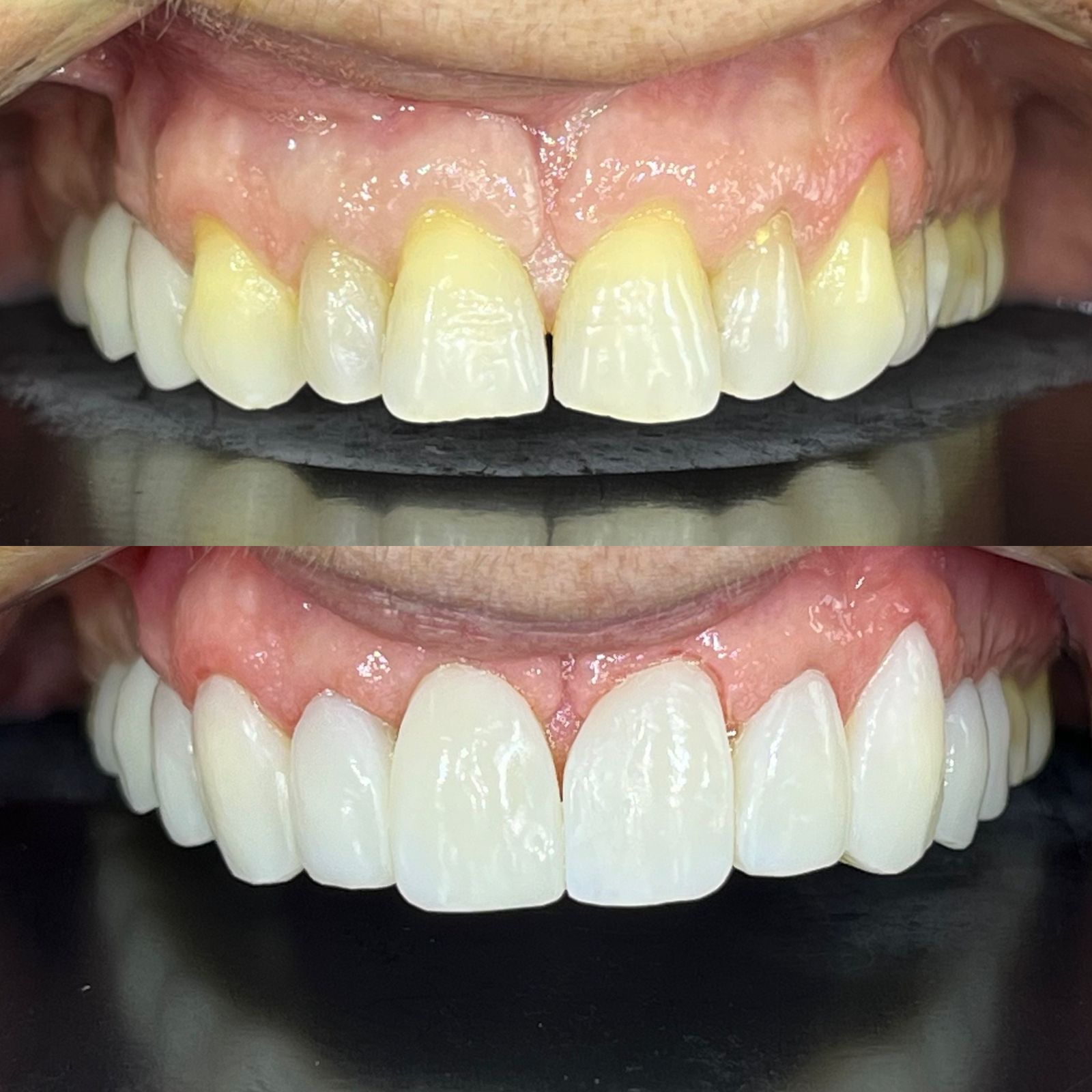 antes-depois-dr-fabio-moura-2