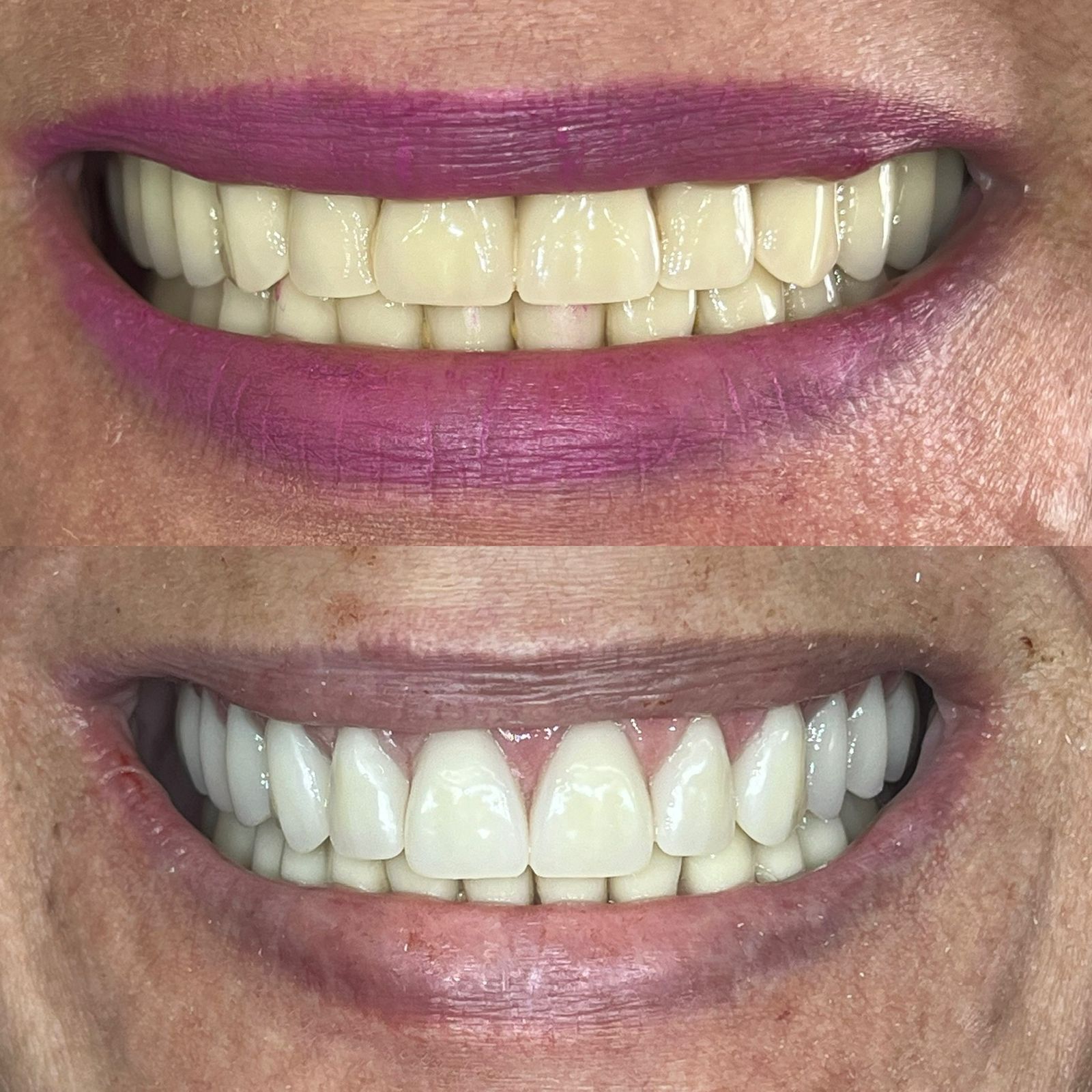 antes-depois-dr-fabio-moura-3