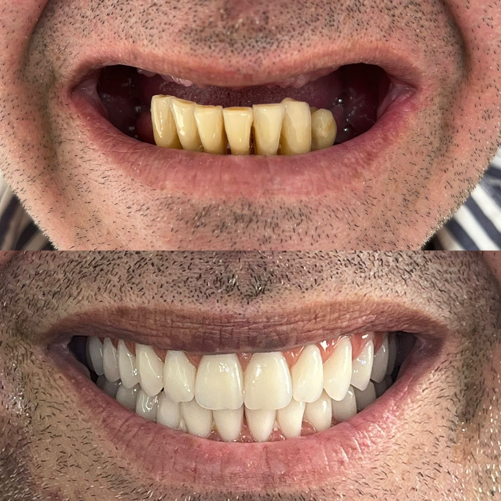 antes-depois-dr-fabio-moura-4