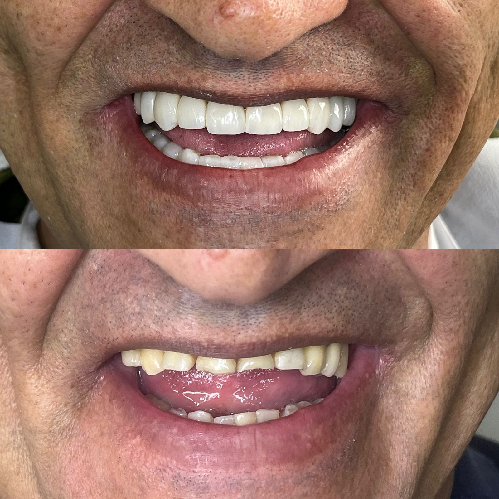 antes-depois-dr-fabio-moura-5
