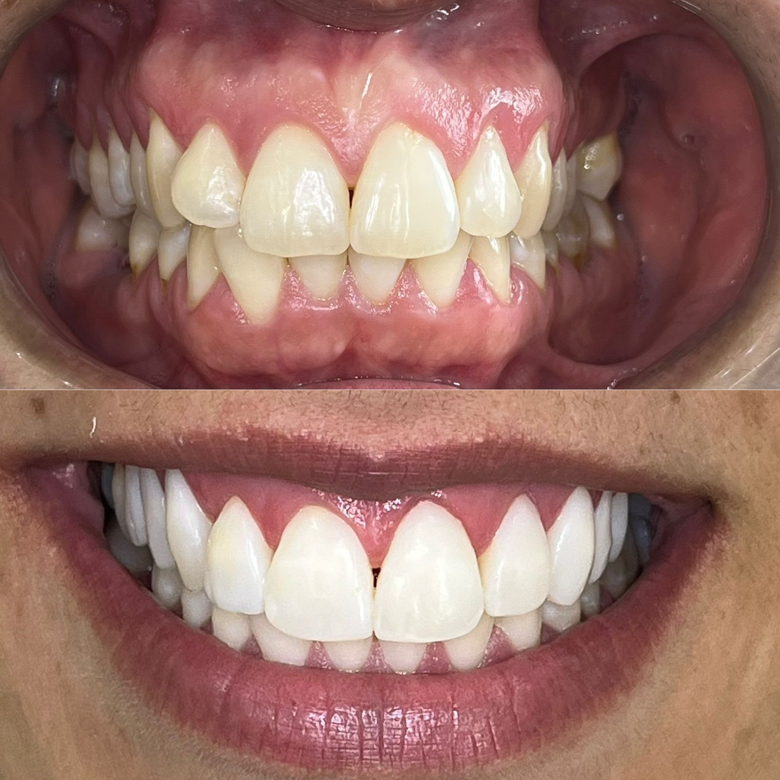 antes-depois-dr-fabio-moura-9